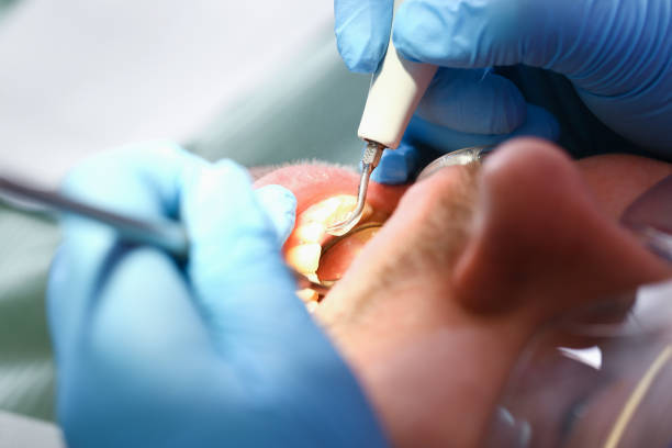 Best Emergency Dental Care for Broken or Chipped Teeth in Highlands, TX