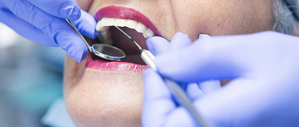 Best Emergency Dental Care for Broken or Chipped Teeth in Highlands, TX